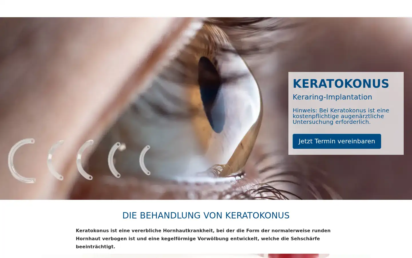 Screenshot of euroeyes.de