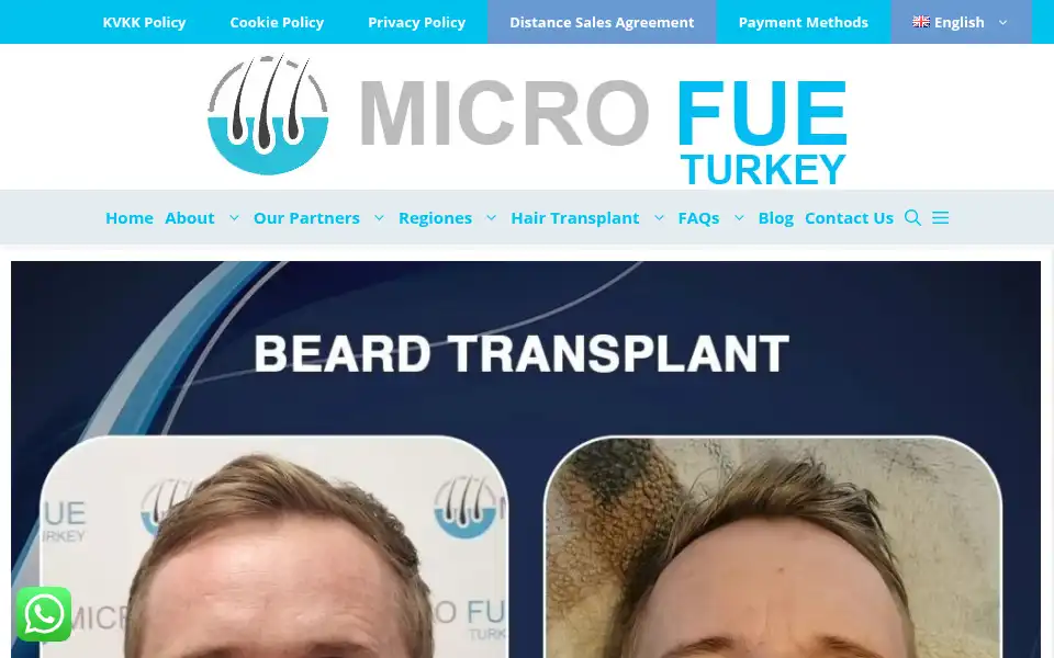 Screenshot of microfueturkey.com